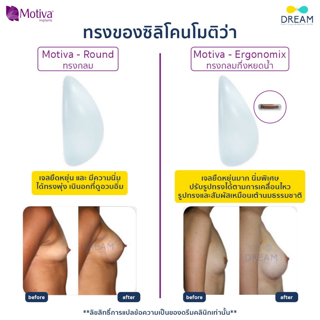 เปรียบเทียบ รุ่น Motiva Round vs Ergonomix silicon motiva, motiva dream